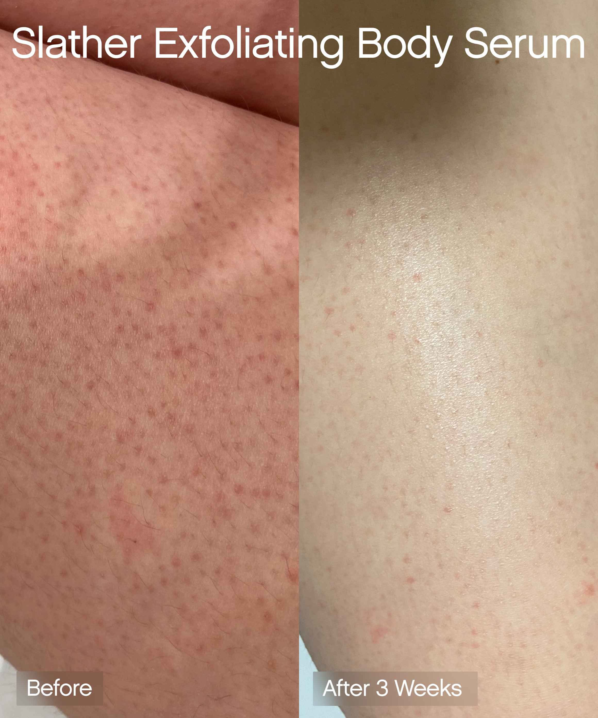 Slather Exfoliating Body Serum